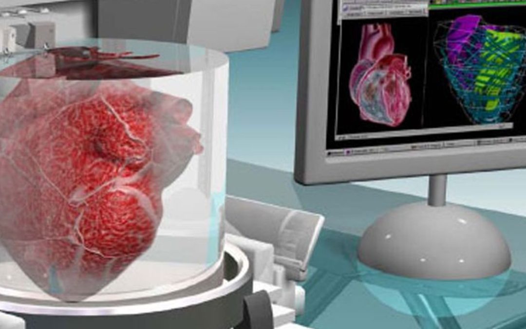 Impressions 3D et médecine