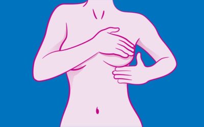 Questions fréquentes sur le cancer du sein