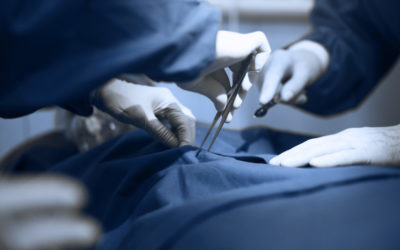 Quels sont les différents types de chirurgie ?