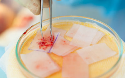 La biologie de synthèse au secours des greffes de peau ?