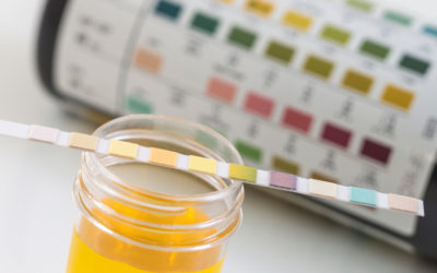 Japon : des tests urinaires favorisant la détection de maladies mentales
